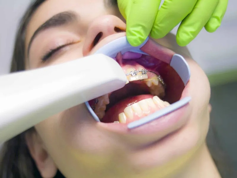 Dental treatment